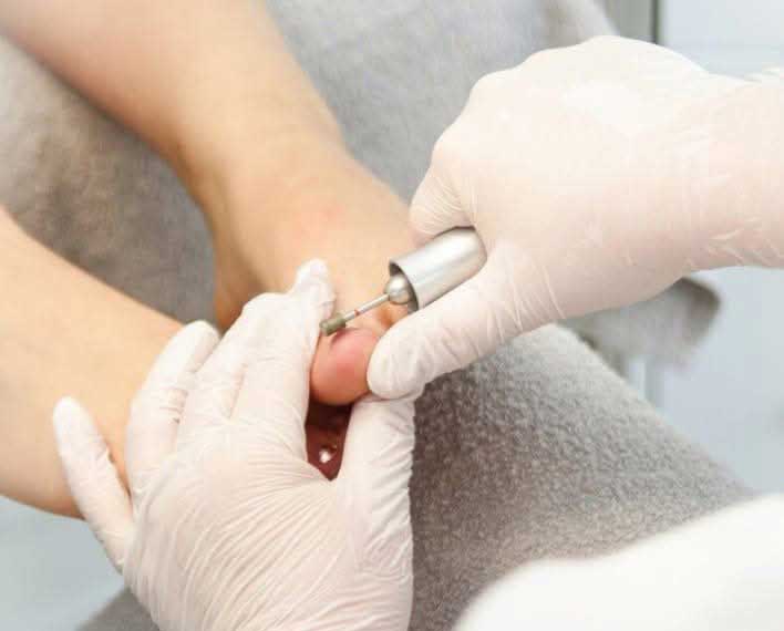 foot care